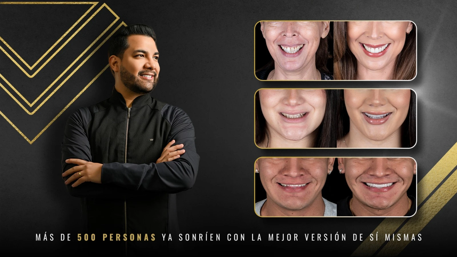 Diseño de Sonrisa