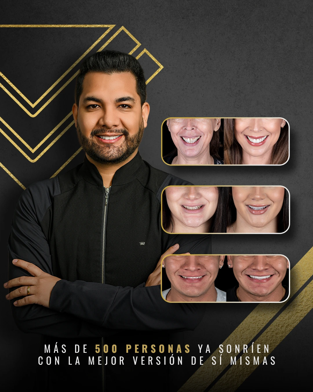 Diseño de Sonrisa Móvil